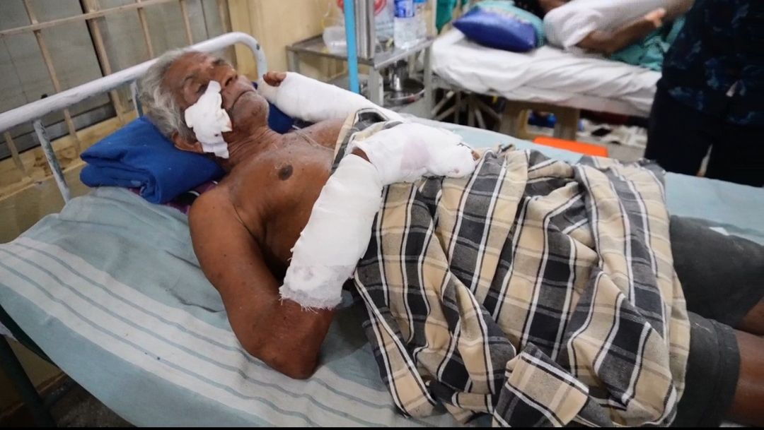 ಕುಂದಾಪುರ: ನೇರಂಬಳ್ಳಿಯಲ್ಲಿ ಹುಚ್ಚುನಾಯಿ ದಾಳಿ – ಮೂವರಿಗೆ ಗಾಯ, ಒಬ್ಬರು ಗಂಭೀರ